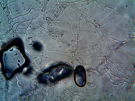  Urocentrum, 몸을 자유롭게 구부리고 지저분한 물속에 살아있는 작은 미생물이야!