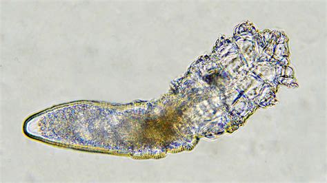   Zoogonus! This Microscopic Parasite Might Just Be Living Inside You Right Now